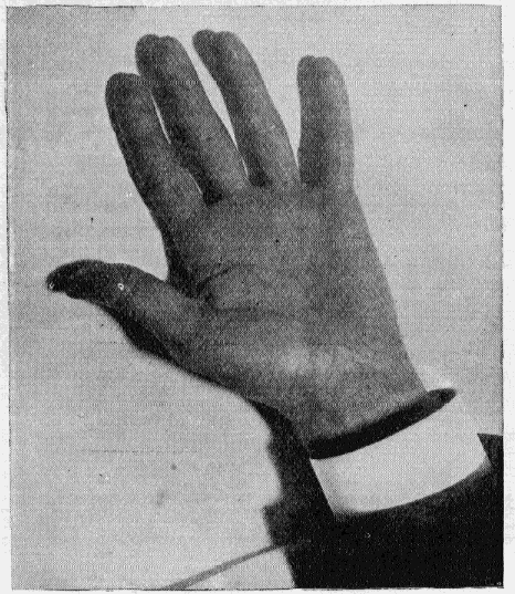 Tesla’s hand illuminated by a wireless lightbulb